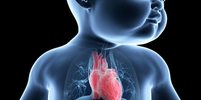 Ի՞նչ է  ձախ սրտի հիպոպլազիայի համախտանիշը